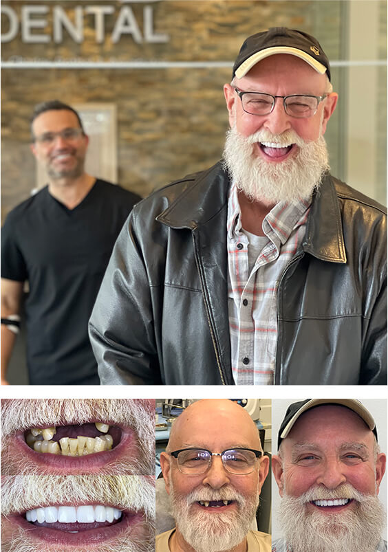 Success Story Teeth-in-1-Day